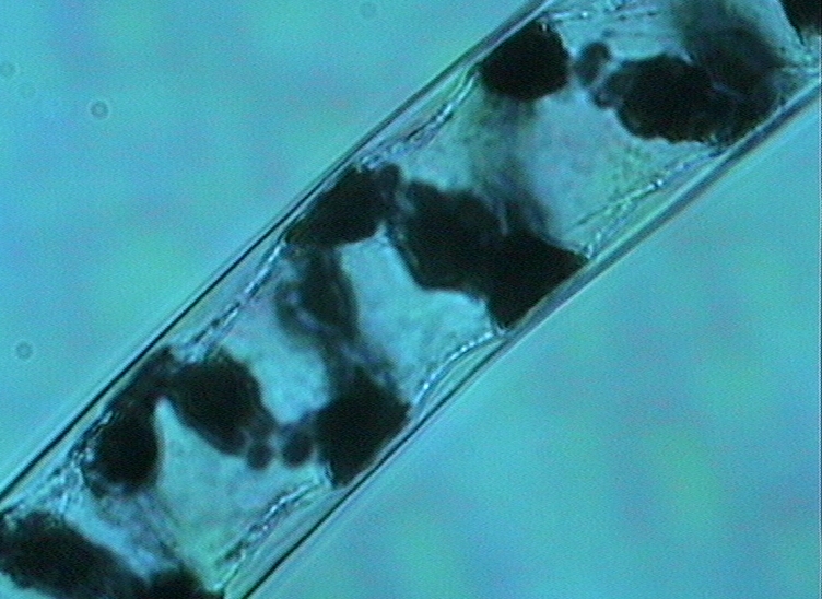 Dictyocha speculum